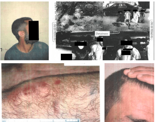 Βασανιστήρια ΗΠΑ σε Ιράκ και Αφγανιστάν: Το Πεντάγωνο έδωσε στη δημοσιότητα φωτογραφίες...λάϊτ