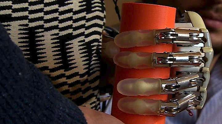 Επιστήμονες δημιούργησαν το πρώτο βιονικό χέρι με αίσθηση αφής!