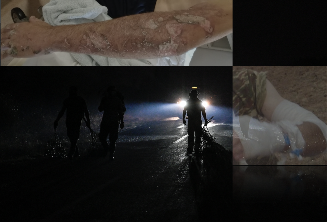 Τραυματισμός δύο στρατιωτικών στον Έβρο: Υπάρχουν φωτογραφίες και πρόβλημα αξιοπιστίας